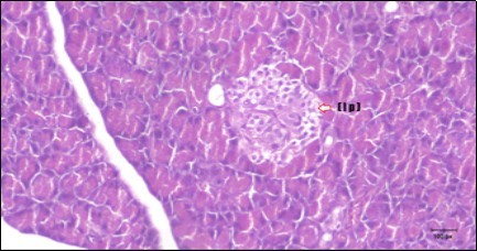 Photomicrogragh of pancreas section of treated rat with Glimepiride showing mildly improved of isled of Langerhans with large number of cells (dashed-arrow). (H&E) (40X).