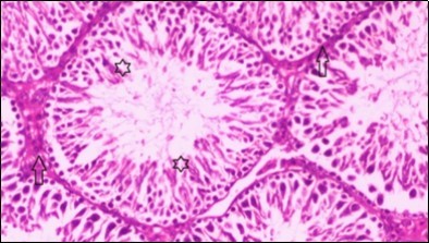 Photomicrogragh of testis section of treated rat showing increased number of spermatogenic cells from spermatogonia till spermatozoa (star). Few liquid infiltration in wide interstitial tissue (H&E) (40X).