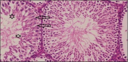 Photomicrogragh of testis section of treated rat with combination of Fenugreek and Glimepiride showing nearly normal appearance of seminiferous tubules with organized spermatogenesis end with large number of spermatozoa (star). Note, Sertoli cells (arrows). (H&E) (40X).
