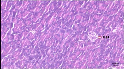 Photomicrogragh of pancreas section of diabetic rat showing the markedly atrophic islets of Langerhans. (arrow) (H&E) (40X).