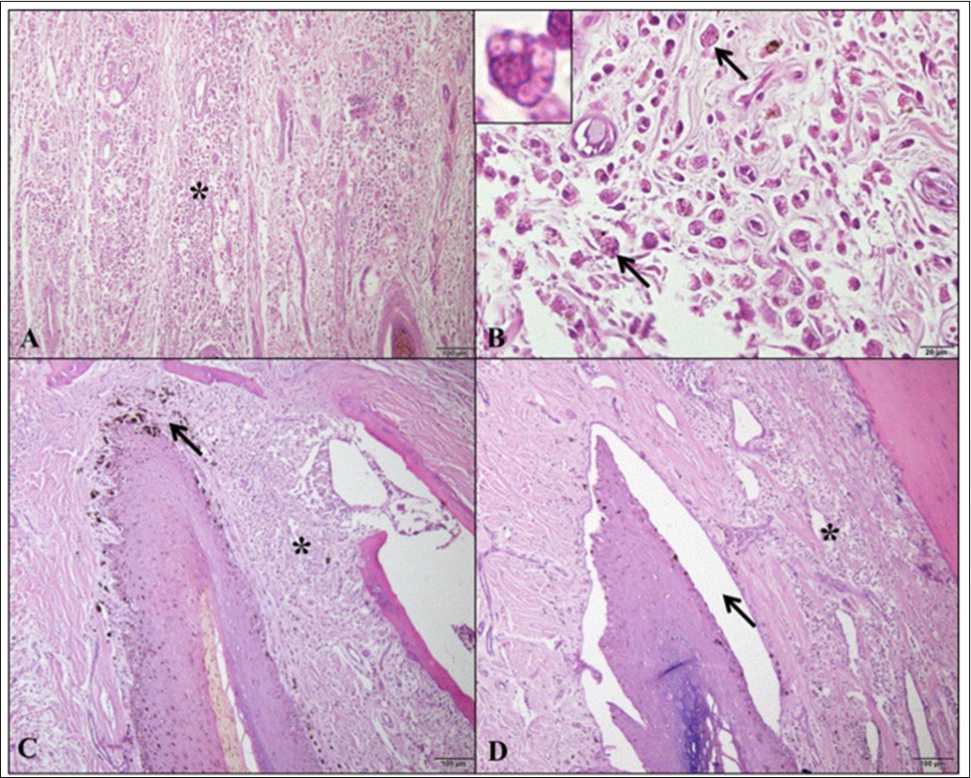 Photomicrographs of histopathological alterations in the different digit areas of dogs with visceral leishmaniasis. (A) Inflammatory infiltrate (*) diffusely dispersed in dorsal epidermis/dermis (bar=100µm). (B) In the same area, inflammatory infiltrate containing macrophages with Leishmania spp amastigotes (arrows and detail, bar=20µm). (C) Inflammatory infiltrate (*) and pigmentary incontinence (arrow) in the dorsal matrix/dermis (bar=100µm). (D) Inflammatory infiltrate (*) and marked dermoepidermal clefting (arrow) in the ventral matrix/dermis (bar=100µm). Hematoxylin and Eosin.