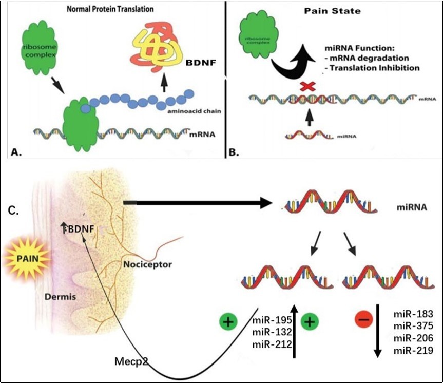 Epigenetic control of miRNA in pain state. A) Normal BDNF protein translaton. B) Functonof miRNA: mRNA degradaton and inhibiton of protein translaton. C) Changes in miRNA expression during pain: some increase, such as miR-195, and some decrease, such as miR-183, these changes cause pain by regulating the expression of BDNF