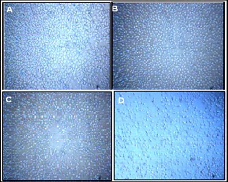 HTB-132 breast cancer cells viability before and after 24 hrs alendronate treatment. A: Control; B, C & D: 5µM, 10 µMand 20 µM ALN respectively.