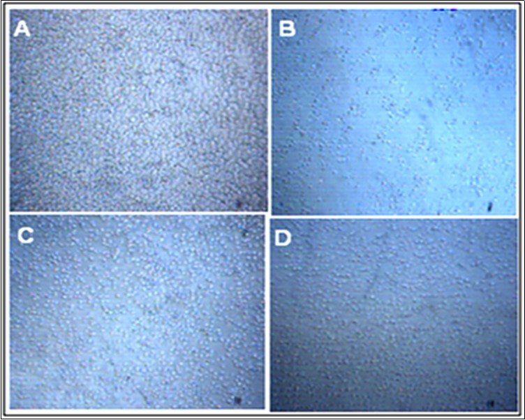 HTB-132 breast cancer cells viability before and after 48 hrs alendronate treatment. A: Control; B, C & D: 5µM, 10 µMand 20 µM ALN respectively.