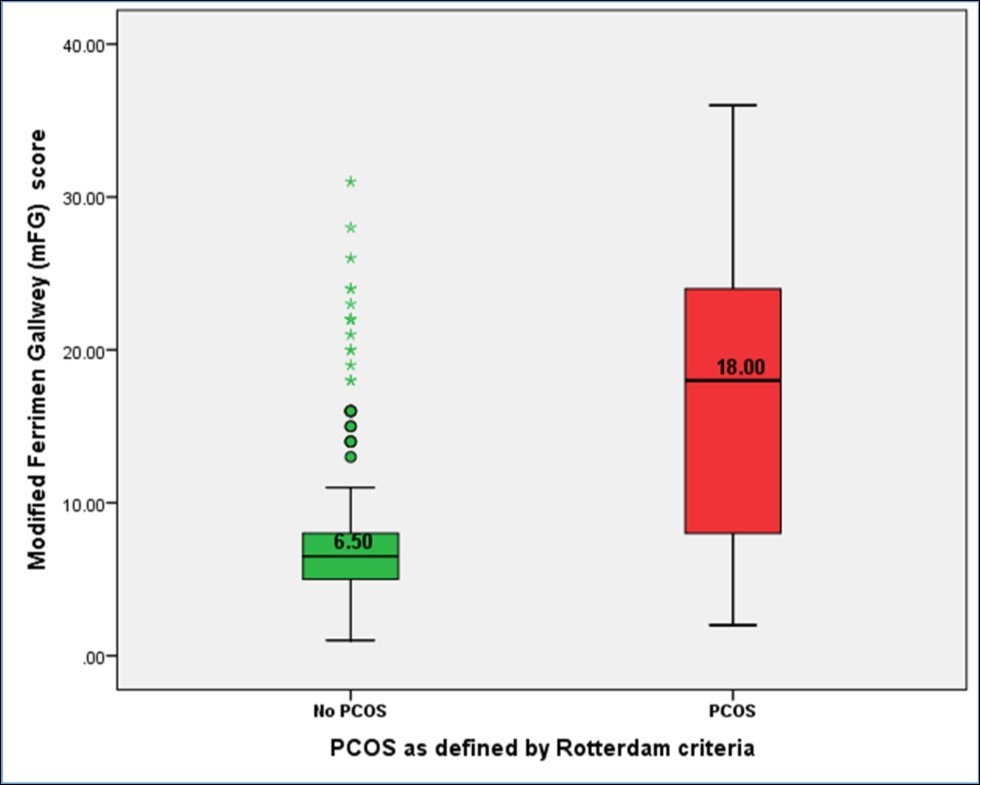 Differences in hirsutism as defined by modified FG score between subjects defined to have PCOS or otherwise as per Rotterdam defined criteria ((PCOS=169, Mean=17.33 + 9.05) (No PCOS=164, Mean=8.21 + 5.74), p< 0.001)