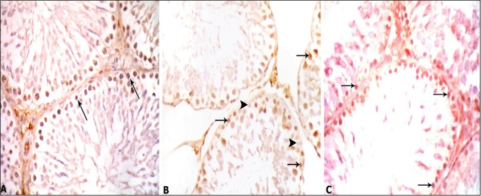 Photomicrographs of testis sections of different groups: A) Control group showing strong positive immunostaining in spermatogonia (arrows). B) PTU-treated group showing weak positive immunostaining with PCNA detected in some spermatogonia (arrows) and negative immunostaining in other spermatogonia (head arrows). C) PTU and LC-treated group showing positive immunostaining with PCNA- stronger than the PTU treated group but still weaker than the control group detected in spermatogonia (arrows). PCNA x 400