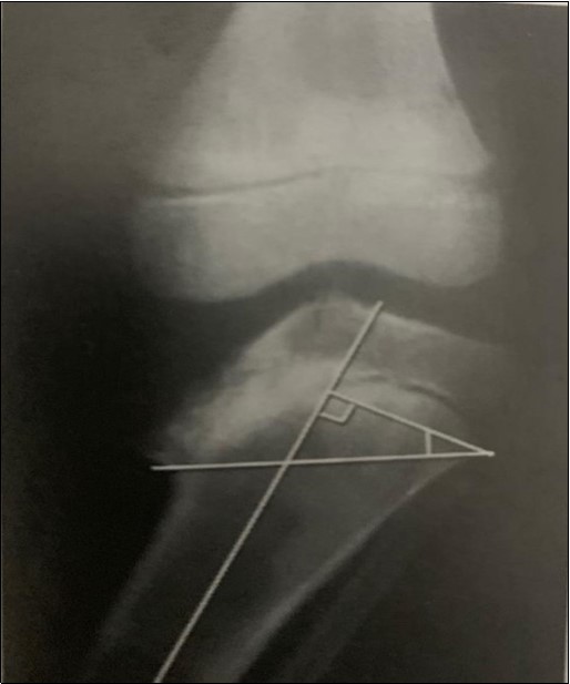 These classification systems are employed to aid diagnosis, monitor progression and to guide treatment of the disease 13