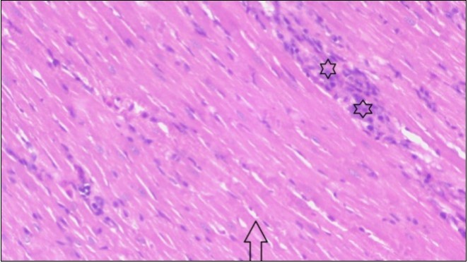 Photomicrograph of heart section of treated rat with fennel herb showing improved cardiac tissue with less infiltration (star) and well organized elongated muscle fibers with peripheral nuclei (arrow), (H&E) (400X).