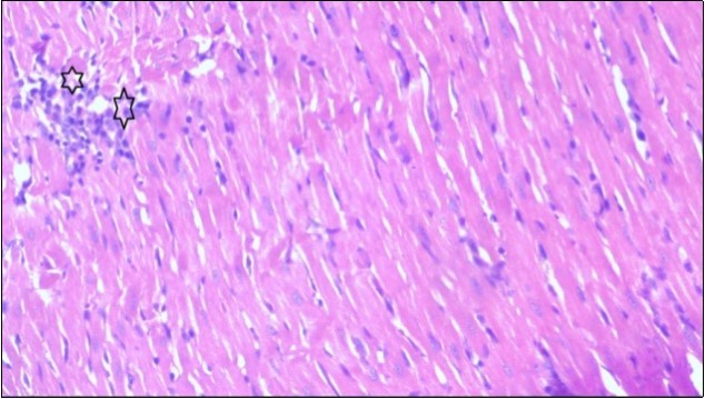 Photomicrograph of heart section of treated rat with Ator drug showing less improved cardiac tissue with few inflammatory cells between disorganized muscle fiber (star), (H&E) (400X).