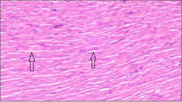 Photomicrogragh of heart section of treated rat with both fennel herb and Ator drug showing nearly normal cardiac tissue with well-organized muscles fibers (arrow), (H&E) (400X).