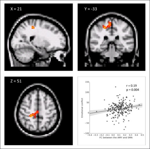 Correlation between seed-based functional connectivity (FC) and emotional conflict. The FC between the AMY and the right supplementary motor area (SMA) was positively correlated with emotional conflict. Scatter plot between the AMY-SMA FC and emotional conflict is shown for illustration purposes.