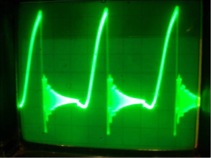 Oscillograph of the voltage on both transistors collectors in the physical model of the system (7) corresponding to the interaction process between two FPU recurrences corresponding to the interaction dynamics of the electron current Ielectron. and that of the phonon current Iphonon . The phonon current energy prevails. Vert axis milli sec/cm, Horiz axis-3volts per cm.
