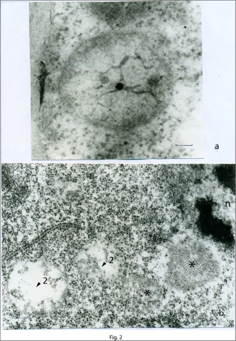Regions of the cells of the apical meristem at a large magnification.Proplastid contained plastid DNA (a) and proplastids at different degree of maturation (b).The developed proplastids are shown by asterisks; plastid DNA is shown by arrows 2. Scale bar = 0.2 μm.