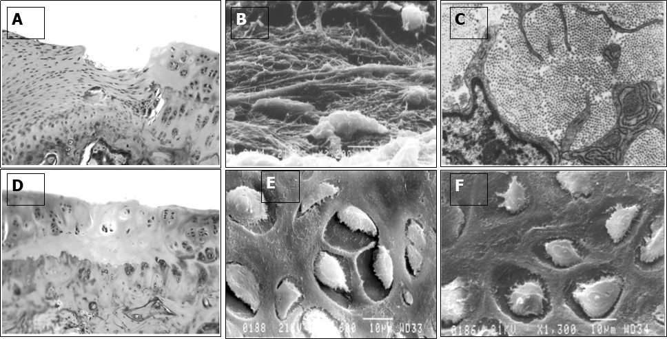 The defect area of the knee joint cartilage in the control (a, b, c) and experimental (d, e, f) groups of animals sixty days after surgery: a, b, c – the defect is replaced by fibrous connective tissue; d, e, f – the defect is filled with a newly formed hyaline cartilage; a, d – paraffin sections, stained by hematoxylin-eosin. Objective lens 10, ocular lens 10; b, e, f – scanning electron microscopy, magnification 1300; c – transmission electron microscopy, magnification 5000.