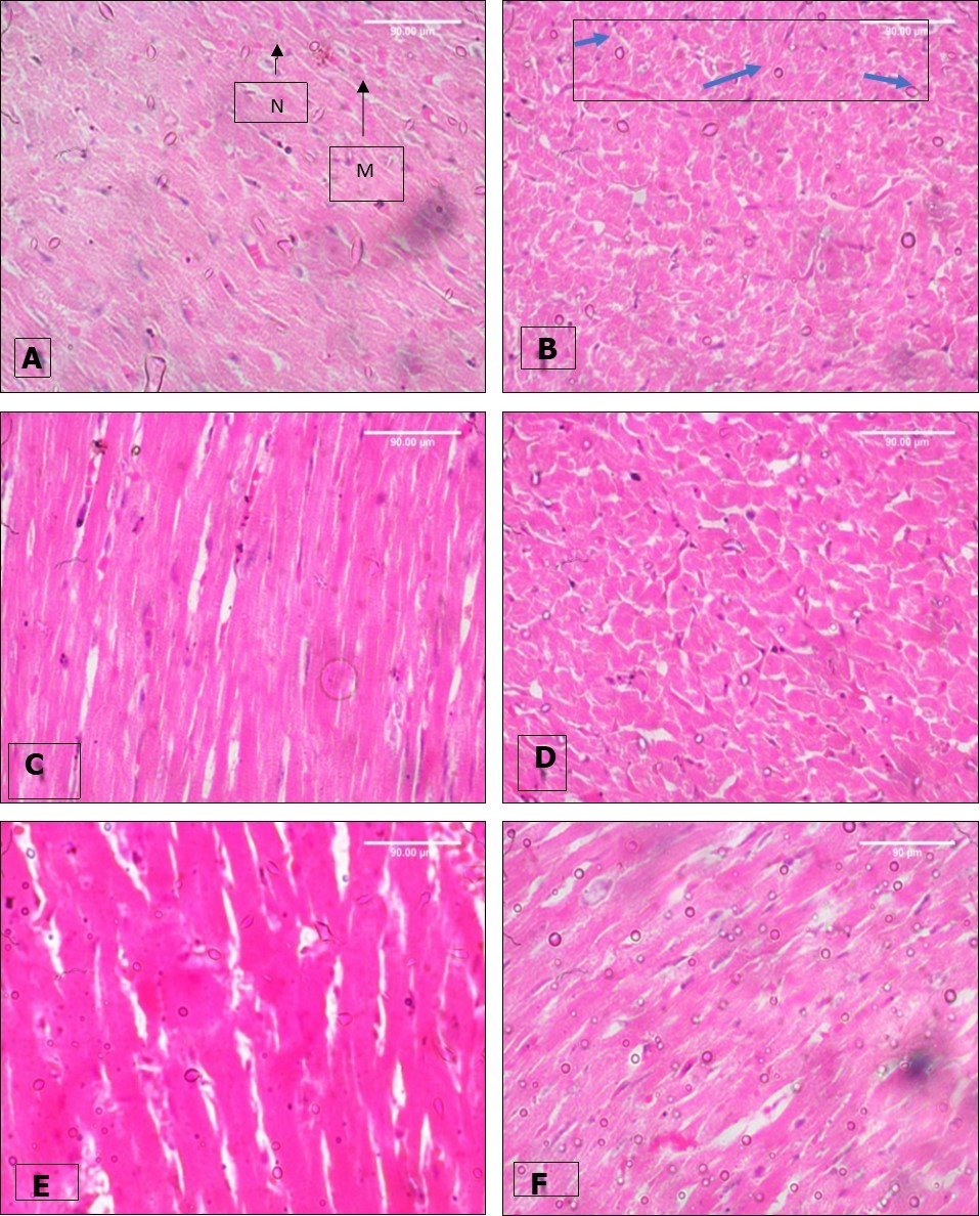 Effect of paraquat exposure on the histo-architecture of the rat heart (A) Control, (B) Paraquat only, (C) MEAS 100mgkg-1, (D) MEAS 200mgkg-1, (E) Vitamin E 100mgkg-1, (F) Paraquat 7mg/kg -Recovery . H&E (x400)