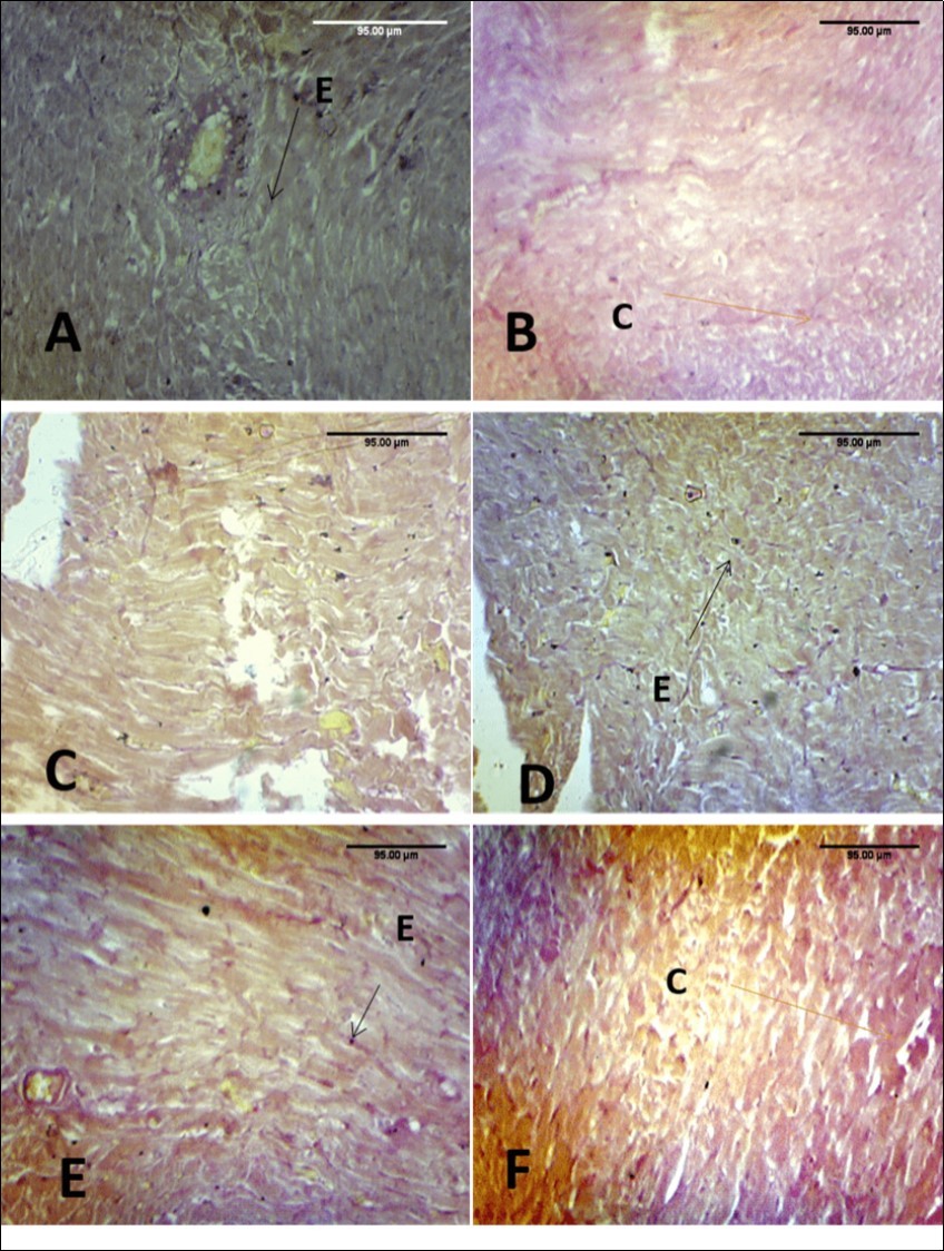 Effect of paraquat exposure on the elastic and collagen fibre distribution of the rat heart (A) Control, (B) Paraquat only, (C) MEAS 100mgkg-1, (D) MEAS 200mgkg-1, (E) Vitamin E 100mgkg-1, (F) Recovery group. VVG (x100)