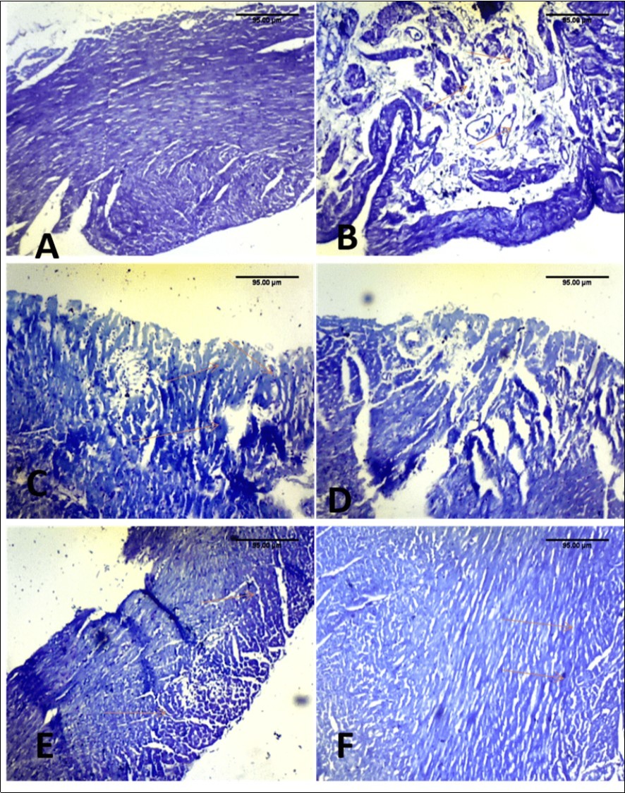 Effect of paraquat exposure on mast cell distribution of the rat heart(A) Control, (B) Paraquat only (C) MEAS 100mgkg-1 (D) MEAS 200mgkg-1 (E) Vitamin E 100mgkg-1, (F) Recovery group. TB(x40)