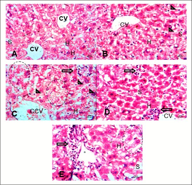 (A-E): Photomicrographs of Liver show the hepatic tissues composed of hepatocytes (H) disposed in sheet, the hepatocytes are seperated by the sinusoids (S). the central vein (CV) is well outlined in (A Control) Section is free from collections and inflamatory cells. (B) Arrow head pointed to kuppfer cells, the central vein appear normal. (C) There was distruption of hepatic parenchyma (circle), increasd number of kuppfer cells (arrow head). (D) perivascular and interstitial infilteration of inflammatory cells (arrow). The hepatocyte (H) and sinusoids appear normal. (E) periportal inflammatory cell infilterate (arrow), marked distruption of the hepatic parenchymal microanatomy (circle). H&E (x400)