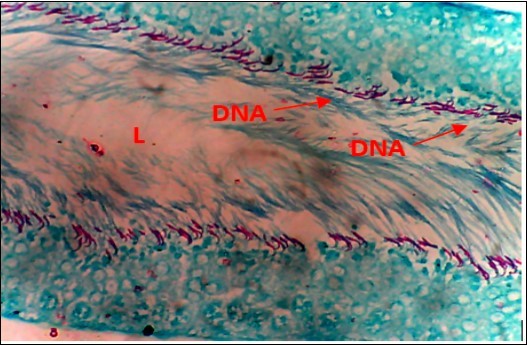 Normal Control (NC) X400 – Section of testis showing numerous deeply stained DNA with magenta color.