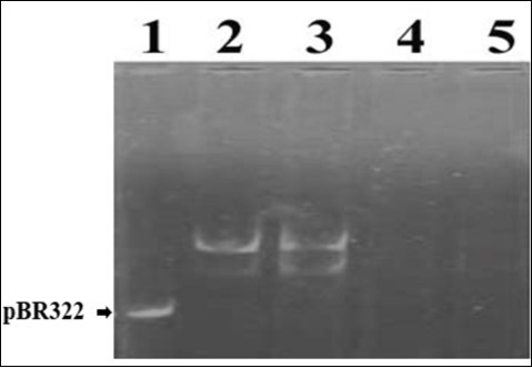 Standardization of plasmid pBR322 concentration and DNA damage by Fenton’s Reagent. Lanes 1-5 contained 15ng of DNA and 0, 1, 2, 3 and 4µl of FR, respectively.