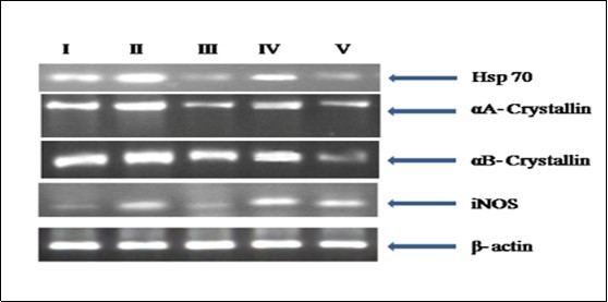 RT PCR analysis for Hsp 70, iNOS, αA and αB crystallin gene expression in the eye lens from different experimental group animals. Reverse transcribed cDNA isolated from- Lane I: control (group I); lane II selenite only (group II); lane III: selenium + resveratrol simultaneously (group III); lane IV: Resveratrol administered 24 h after treatment with selenite (group IV); lane V: Resveratrol administered 24 h before treatment with selenite (group V).
