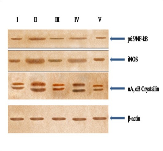 Western blot analyis for p65/NF-kB, iNOS, αA and αB crystallin protein expression in the eye lens from different experimental group animals. Lens homogenates from from- Lane I: control (group I); lane II selenite only (group II); lane III: selenium + resveratrol simultaneously (group III); lane IV: Resveratrol administered 24 h after treatment with selenite (group IV); lane V: Resveratrol administered 24 h before treatment with selenite (group V). ). Separated lens protein was pre-incubated with anti-iNOS, p56/NF- kB and αA, αB crystallin polyclonal rabbit antibody (1: 500 dilution) and subsequently with goat anti-rabbit IgG-HRP (1: 2500 dilution). The immunoreactivity was developed with 0.01% DAB and H2O2.