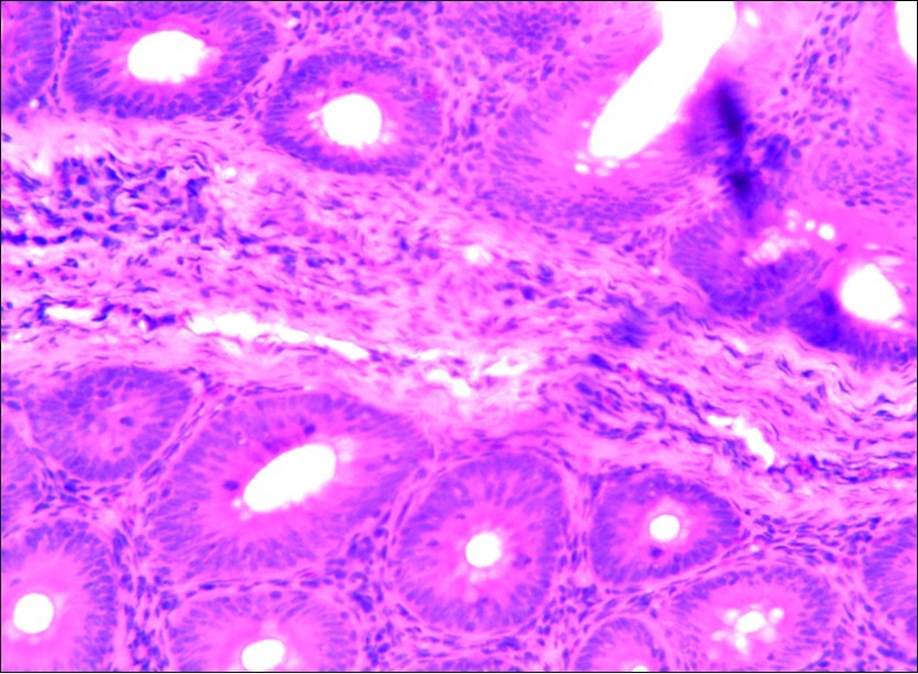 Photomicrograph of caecum of chick uninfected and untreated showing no observable lesion X250 (H&E).