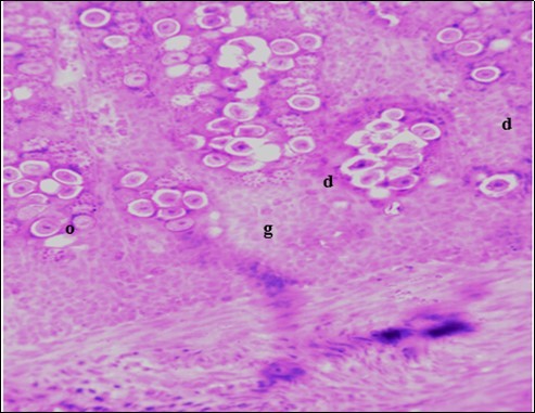 Photomicrograph of caecum of chick administered 20000 Oocysts of Eimeria tenella and untreated showing generalized degeneration of the caecal glands (d) with massive Ocysts (o) and gametocytes (g) largely within the caecal glands X250 (H&E).