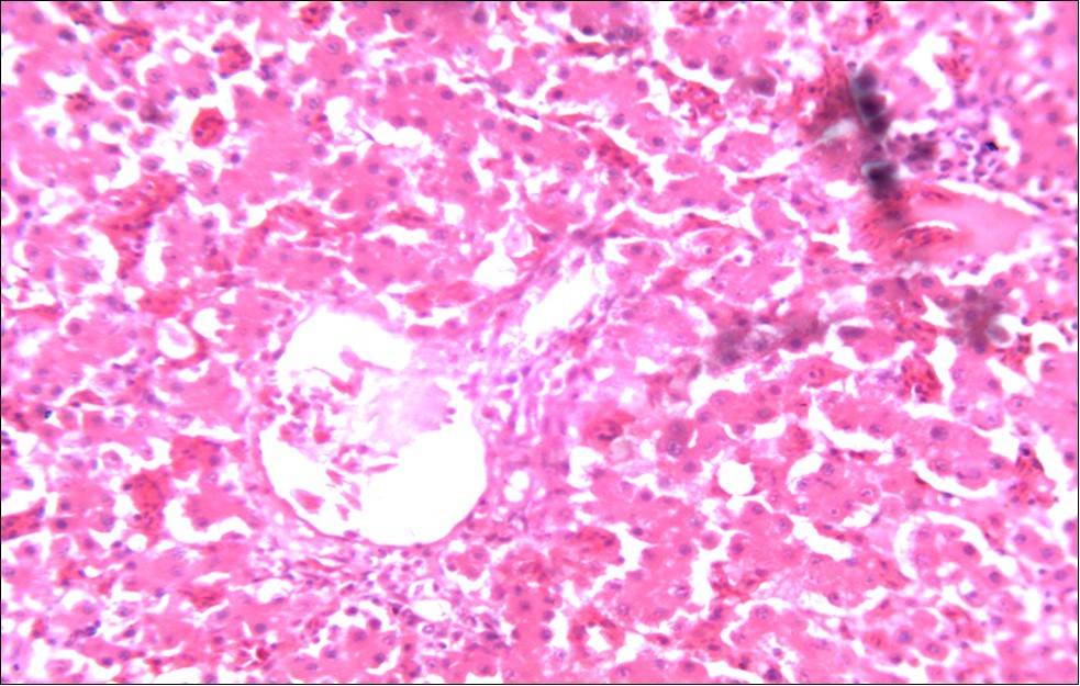 Photomicrograph of liver of chick administered NeemAzal® at 200 mg/kg showing no observable lesion X250 (H & E)