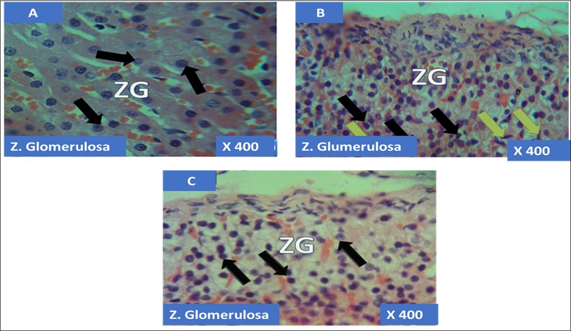 showing the cellular layer of Zona Glomerulosa of Adrenal gland group A (control), group B (T1) and group C (T2). The evenly distributed normal columnar cells with dark nuclei in A (black arrows), evenly distributed normal pyramidal cells (black arrows) with few obliterated cells (green arrows) in B and in C, the black arrows pointing to the evenly distributed normal polydhedral cells (black arrows) having long, straight cords of large cells, swollen with lipid droplets. H&E x400