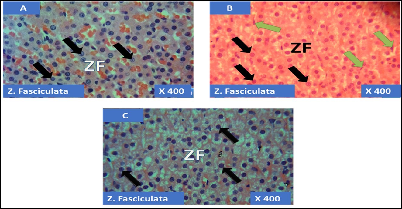 showing the cellular layer of Zona Fasiculata of Adrenal gland group A (control), group B (T1) and group C (T2). The evenly distributed normal large polydhedral cells having long, straight cords, swollen with lipid droplets in A (black arrows), evenly distributed normal polydhedral cells (black arrows) with few obliterated cells(green arrows) in B and in C, the black arrows pointing to the evenly distributed normal polydhedral cells (black arrows). H&E x400