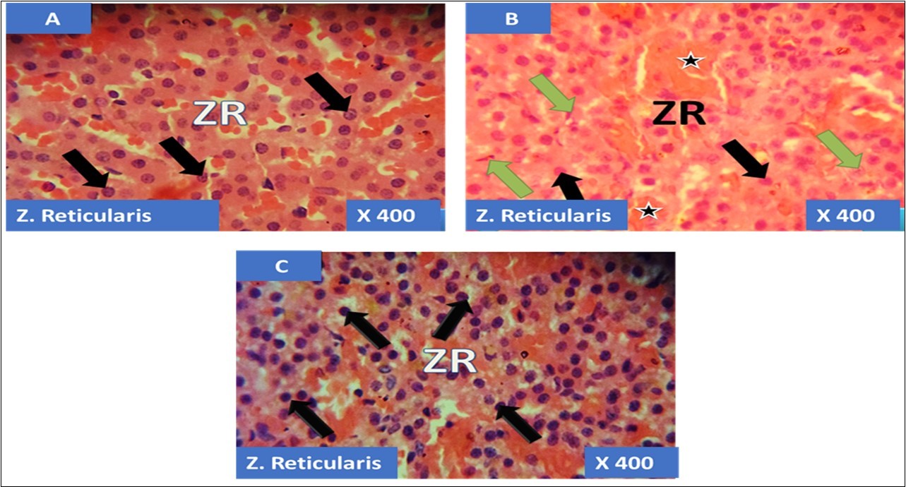 showing the cellular layer of Zona Reticulosa of Adrenal gland group A (control), group B (T1) and group C (T2). The evenly distributed normal polydhedral cells in A (black arrows), evenly distributed normal polydhedral cells (black arrows) with few obliterated cells (green arrows) as well as haemorrhagic necrosis sites (Black stars) in B and in C, the black arrows pointing to the evenly distributed normal polydhedral cells (black arrows). H&E x400