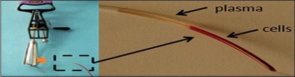 Plasma isolation using an egg beater centrifuge [86).