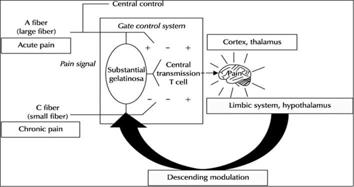 The Gate Control System, by Melzack and Wall 1965