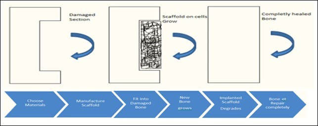 Bone Repairing Process