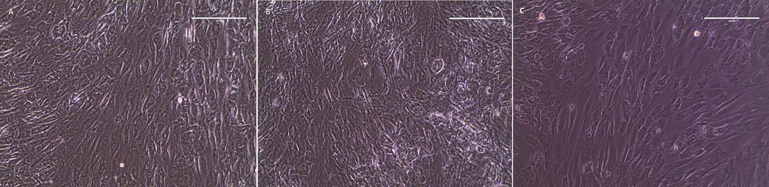 Phase contrast microscopy of rabbit ASC cultured under adipogenic (A), osteogenic (B), and control (C) conditions for 14 days on 2-dimensional plastic culture plates. Both experimental conditions have lost the spindle shape and linear arrangement still present in the control. Magnification 20x; scale bar 200m.