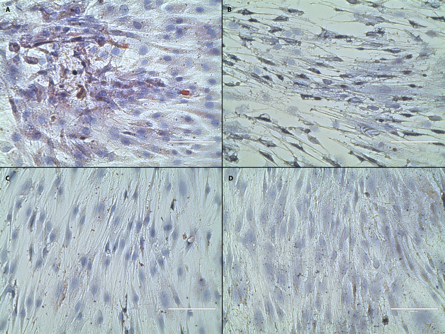 Histologic assessment of rASC differentiation after 28 days of culture on 2- dimensional plastic culture plates. Adipogenic culture (A), osteogenic culture (B), and control culture (C and D). Left column shows Oil Red O staining lipid droplets red in (A) but not (C). Right column shows Von Kossa staining mineral deposits black in (B) but not in (D). Magnification 40x; scale bar 100 um; hematoxylin counterstain.