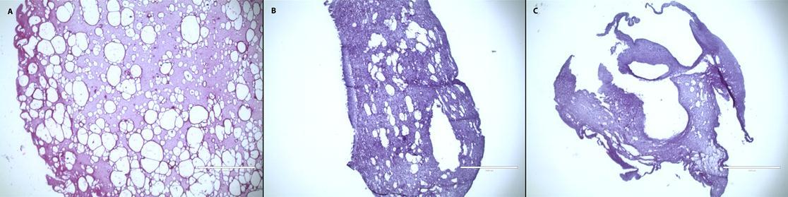 Rabbit ASC constructs formed with human cryoprecipitate show progressive vacuolization and compaction on days 1(A), 4 (B), and 7 (C). Magnification 4x; scale bar 1 mm.