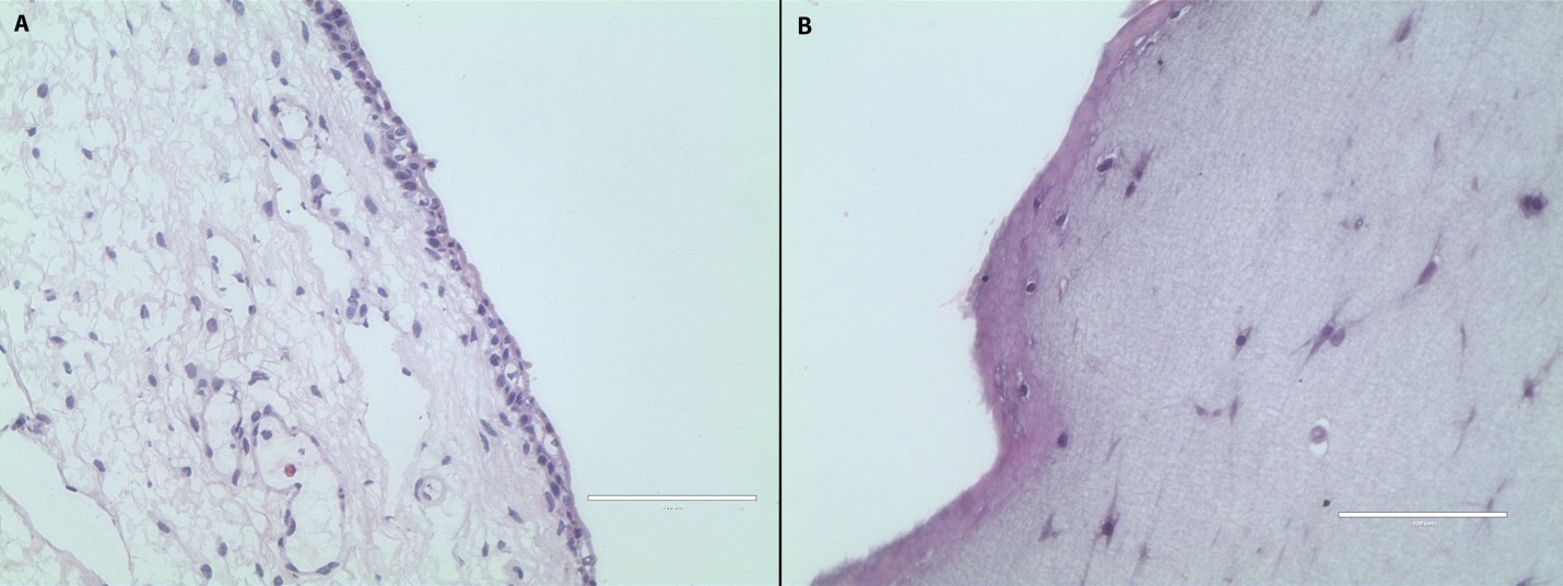 Hematoxylin and eosin staining of rabbit true vocal fold (A) and a fibrin-rASC construct (B). The construct after 14 days of culture with EGF demonstrates a bilayered structure with cells attached throughout the construct. Magnification 40x; scale bar 100 µm.