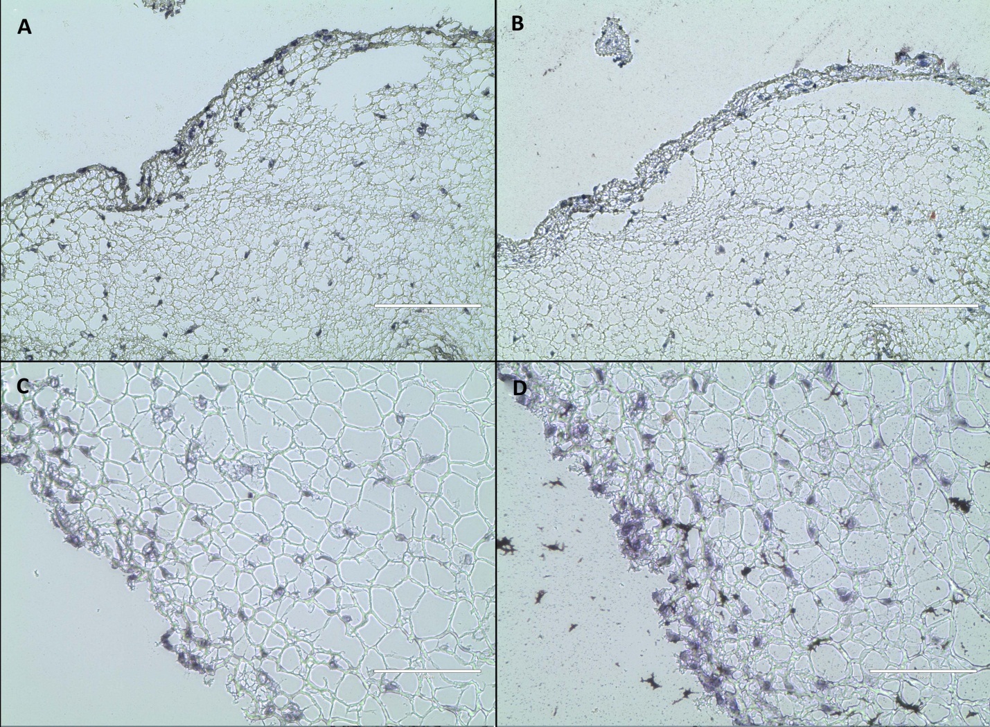 Histologic assessment of rASC differentiation in fibrin constructs after 14 days in culture without EGF (top row) and with EGF (bottom row). Von Kossa (A and C) and Oil Red O (B and D) show no staining respectively for either mineral or lipid. Magnification 20x; scale bar 200 µm, counter-stain with hematoxylin in all.