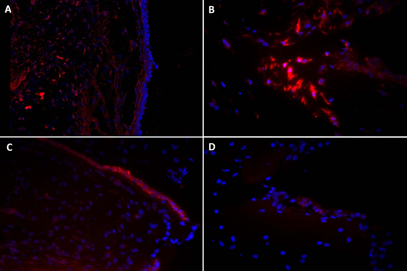 Immunohistochemistry in rabbit true vocal fold (left column), and a fibrin-rASC construct after 14 days in culture with EGF (right column). Vimentin (top row) and cytokeratin (bottom row) appear red, DAPI-labeled nuclei appear blue. A. Vimentin is expressed throughout vocal fold lamina propria. B. Vimentin is expressed in all cells within the construct. C. Cytokeratin is expressed in all cells in the vocal fold epithelium. D. Cytokeratin is indistinguishable from negative control construct samples. Magnification 40x.