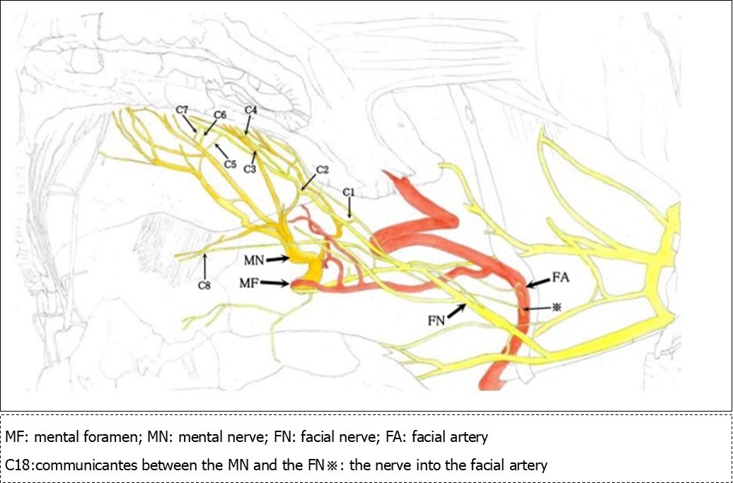 Sketch of the mental nerve, marginal mandibular branch of the facial nerve and the facial artery