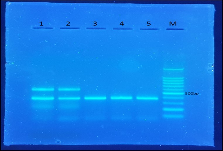 CALL primers (1 and 2) show double bands of 700 bp and 400 bp whereas the VHH primers (3,4 and 5) give only one band of 400 bp