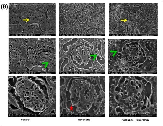 Scanning electron micrographs of kidney of rotenone and co- administration of quercetin mice . Control group showing normal architecture of renal corpuscles with their glomeruli (Yellow arrows) and renal tubules (green arrow head). Photomicrograph of kidney treated with rotenone showing alteration in renal corpuscles (yellow arrows); degeneration of renal tubules (green arrow head), wide spacing of tubules with atrophy of their lining epithelium (red star).Photomicrograph of kidney treated with rotenone + quercetin showing normal appearance of renal corpuscles and renal tubules.