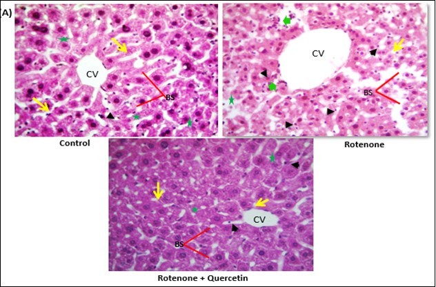 Effect of rotenone and co-treatment of quercetin and rotenone on histology of liver of mice. Control liver showing normal appearance classic hepatic strands (yellow arrows) with hepatocytes (green asterisk) of control mice separated by blood sinusoids (Bs) (red line); Central vein (CV). Rotenone treated group, showing degranulation of hepatocytes cytoplasm, loss of hepatic strands (yellow arrows); abnormality in sinusoids (red line); shrinkage of hepatocytes ( green asterisks),Leucocytes infiltration (green arrow head) and Kupper cells activation (black arrow head). Rotenone + quercetin treated group showing classical hepatic strands (yellow arrows); normal structure of blood sinusoids (Bs); central vein (Cv); normal appearance of hepatocytes ( green asterisks) and least number of Kupper cells activation (black arrow head). Tissues sections (about 5 μm) were prepared, stained with haematoxylin and eosin (H&E). Magnification, 40×