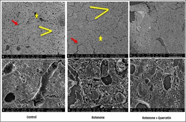 Scanning electron micrographs of liver of rotenone and co- administration of quercetin mice . Control group showing normal appearance of hepatocytes strands ( red arrow), central vein (yellow star); surrounding the normal sinusoids (yellow line ), Rotenone administrated group, shows loss of hepatic strands (red arrows); abnormality in sinusoids (Yellow line). Rotenone + quercetin treated group showing classical hepatic strands ,normal structure of blood sinusoids , central vein and normal appearance of hepatocytes .Scale Bar 200 μm and 10 μm.