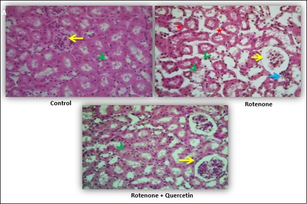 Effect of quercetin and co-treatment of quercetin and rotenone on histological alteration of mice kidney following exposure to rotenone.(A) Control group showing normal architecture of renal corpuscles with their glomeruli (Yellow arrows) and renal tubules (green arrow head). Photomicrograph of kidney treated with rotenone showing alteration in renal corpuscles (yellow arrows); degeneration of renal tubules (green arrow head) and necrosis and wide spacing of tubules with atrophy of their lining epithelium (red star), focal interstitial chronic inflammation infiltration of lymphocytes and mononuclear cell interstitium (blue arrow). Photomicrograph of kidney treated with rotenone + quercetin showing normal appearance of renal corpuscles and renal tubules. Kidney tissue sections were stained with hematoxylin and eosin method (40x).