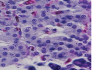 Normal Photomicrograph of the pancreas from a non-diabetic healthy rat demonstrating normal histoarchitecture (H &E stain X400 magnification)