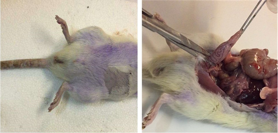Torsion/detorsion surgical process: (A) before surgical, (B) after surgical.