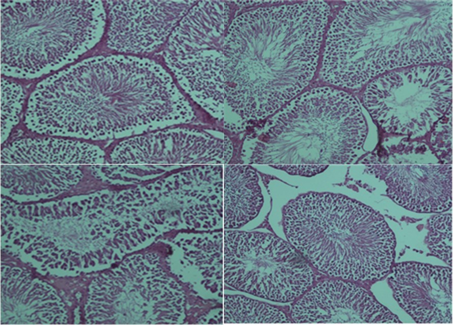 Light microscope observations of H&E stained sections (×100). (A) positive control group: normal testicular architecture was seen. (B) Health group+ ozone/oxygen (30µg/ml). (C) torsion/detorsion. (D) torsion/detorsion + ozone/oxygen (30 µg/ml) therapy group.